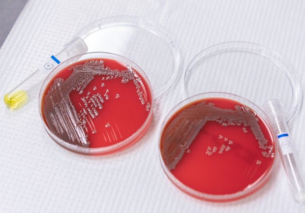 Petri dishes with red liquid